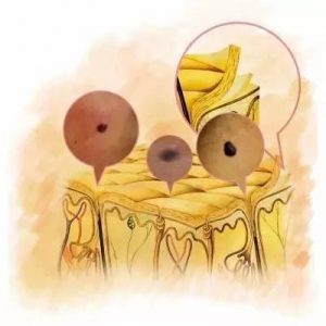 恶性黑色素瘤可以通过母乳传染吗?